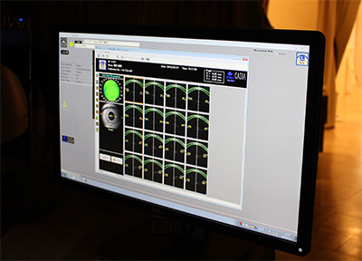前眼部OCT（CASIA）による解析画像例