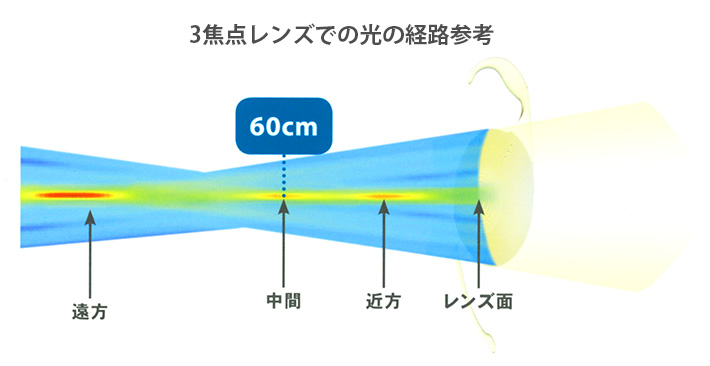 3焦点眼内レンズ(トリフォーカルレンズ)での光の経路参考